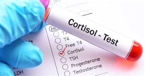 cortisol blood test bottle|random cortisol normal range uk.